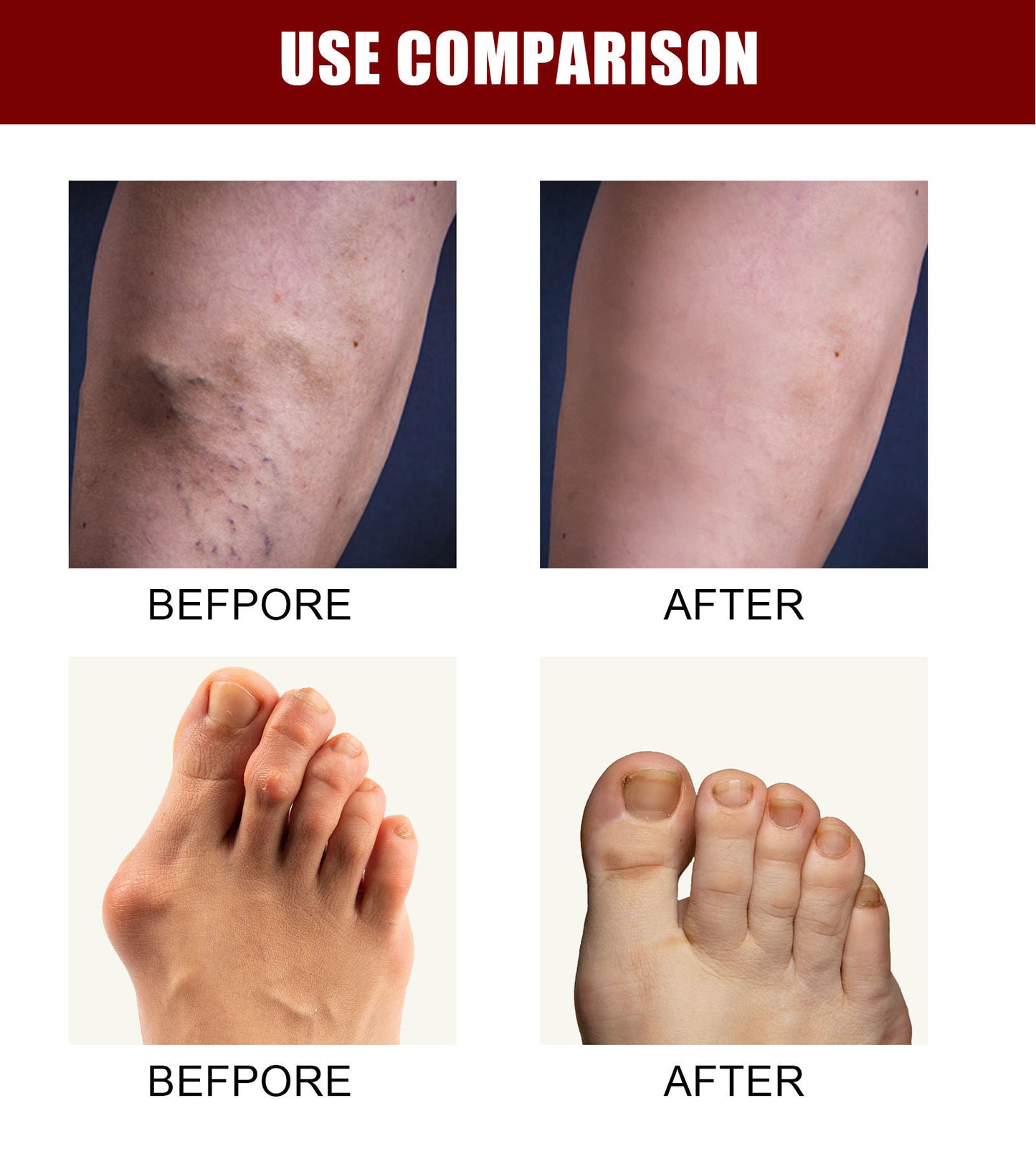 Perfectx Joint And Bone Therapy Cream