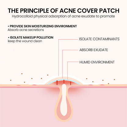 Pimple Spot Patches