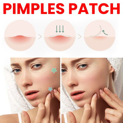 Pimple Spot Patches