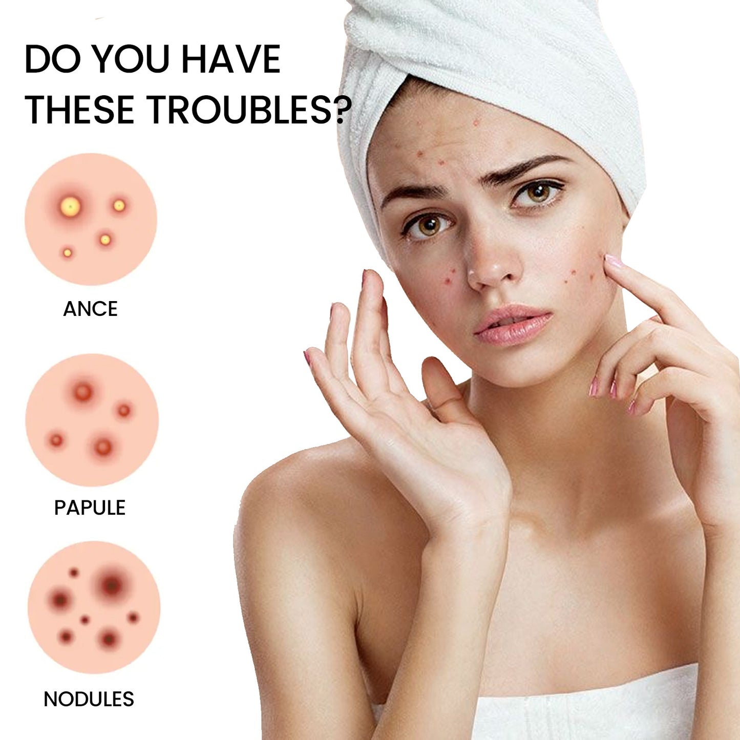 Pimple Spot Patches